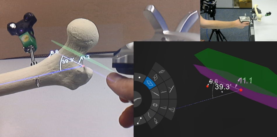 OrthoCAD: Chirurgisches CAD-System mit Augmented-Reality-Unterstützung